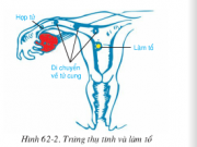 Bài 62 trang 195: Thụ tinh, thụ thai và phát triển của thai Sinh học 8