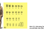 Bài 1, 2, 3, 4, 5, 6 trang 111 SGK Sinh học 12 Nâng cao – Nêu mục đích, nội dung và kết quả của phương pháp nghiên cứu phả hệ.